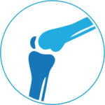 Joint and knee replacement surgery in Indian hospitals